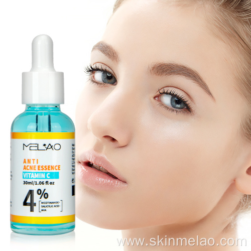Anti Acne treatment Pimple Remover Serum